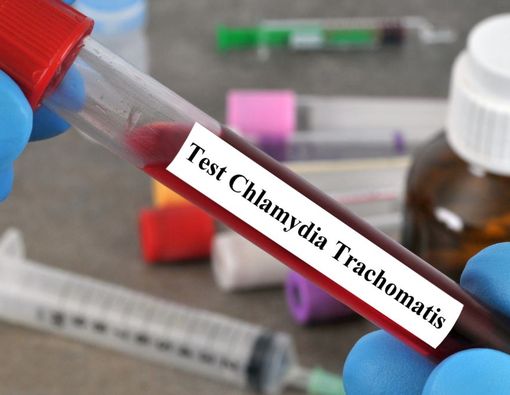 Chlamydia